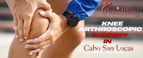 Complete Information on Knee Arthroscopic Surgery in Cabo San Lucas, Mexico